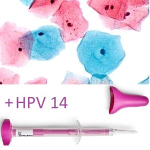 LBC szczoteczka HPV