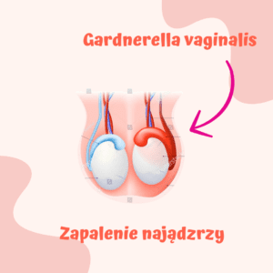 Gardnerella vaginalis u mężczyzn